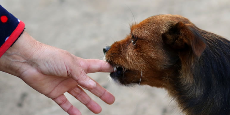 Собака кусает хозяина за руку